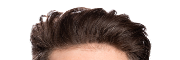 The top of Adam's head